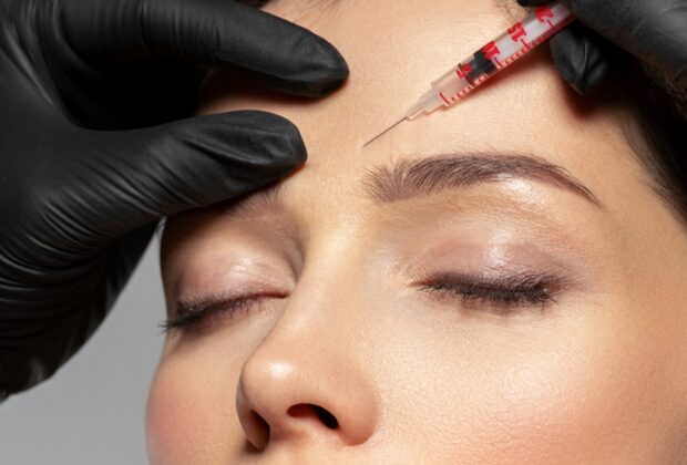 Botox for Migraines